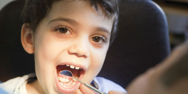 carie nei denti da latte