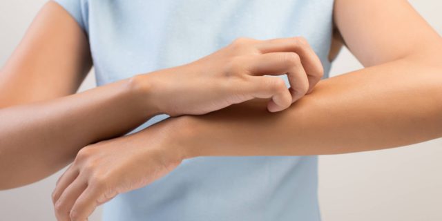 Dermatite erpetiforme celiachia
